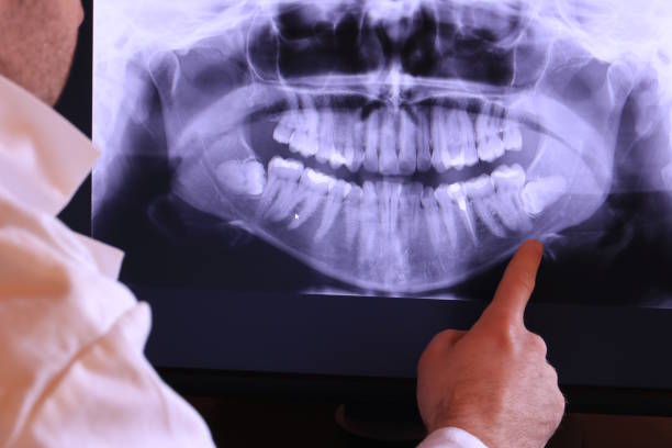 Best Emergency Dental Care for Broken or Chipped Teeth in Howland Center, OH