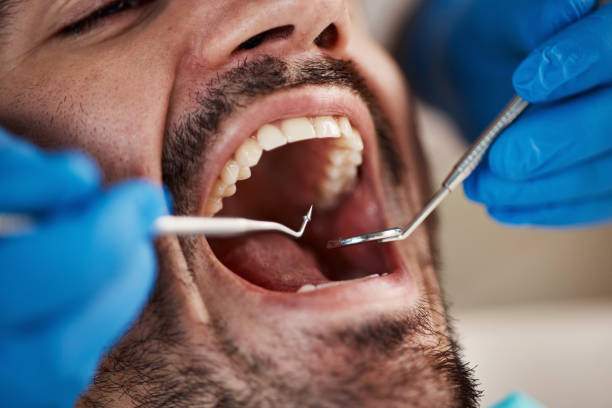 Best Emergency TMJ Treatment in Howland Center, OH