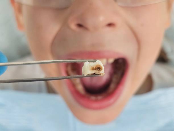 Best Urgent Care for Lost Fillings or Crowns in Howland Center, OH